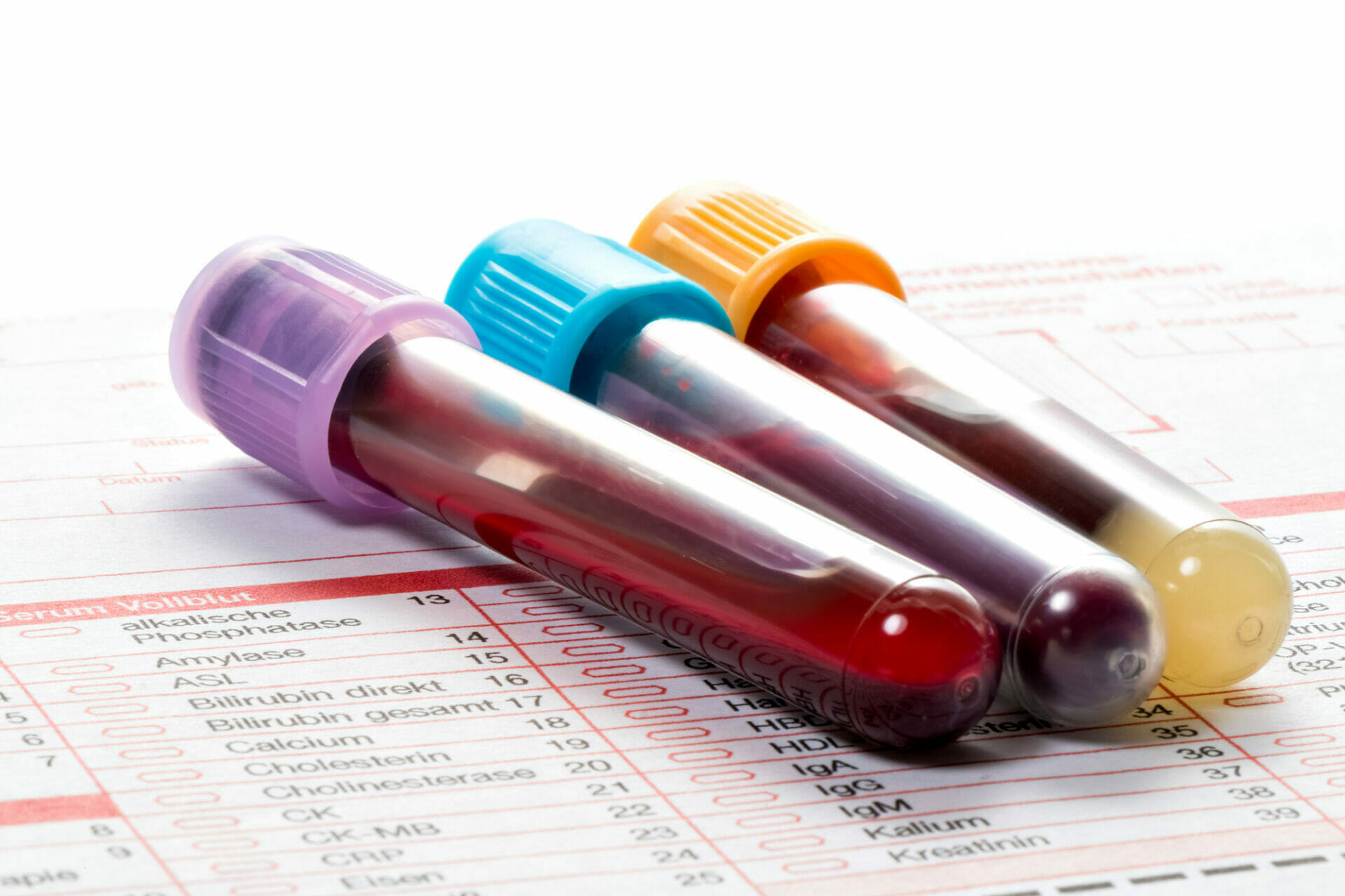 Blood tests 1.jpg