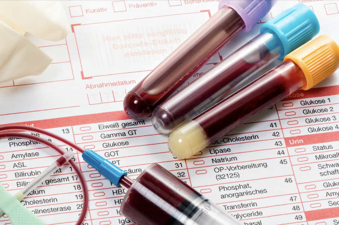 Blood Tests Reigate Private GP Clinic