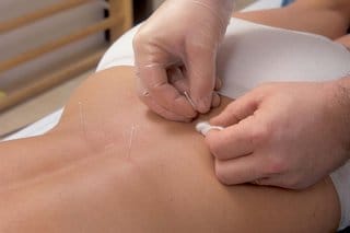 Pgp acupuncture.jpg